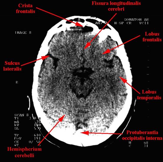 anatomia radiologiczna - 07a.jpg